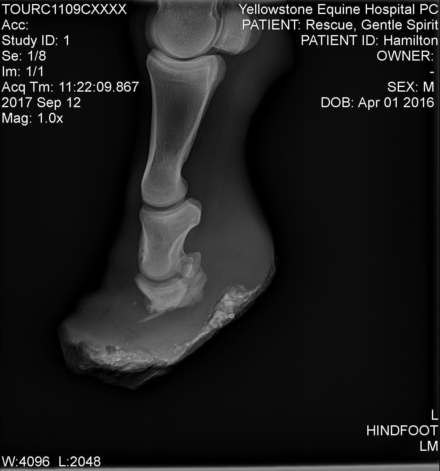 hamiitonxray